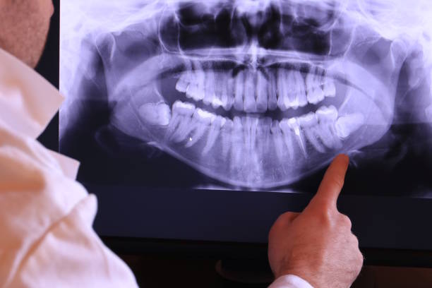 Best Urgent Tooth Repair  in Dunnellon, FL