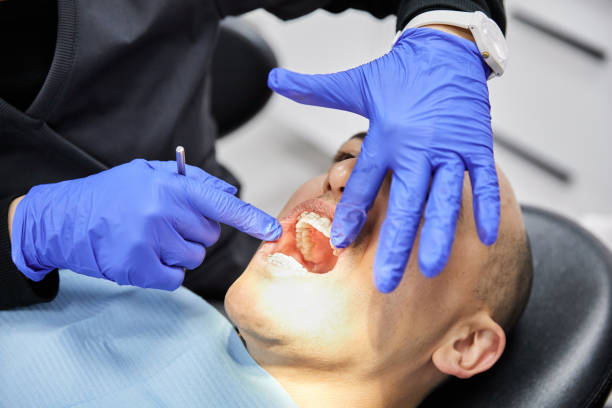 Best Cracked Tooth Emergency Dentist  in Dunnellon, FL
